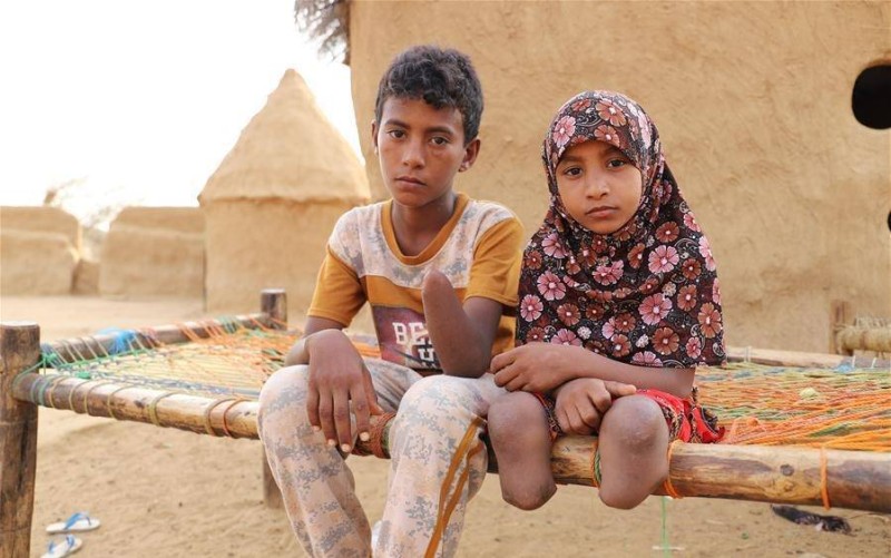 أطفال ضحايا ألغام الحوثي مصابون بإعاقة دائمة