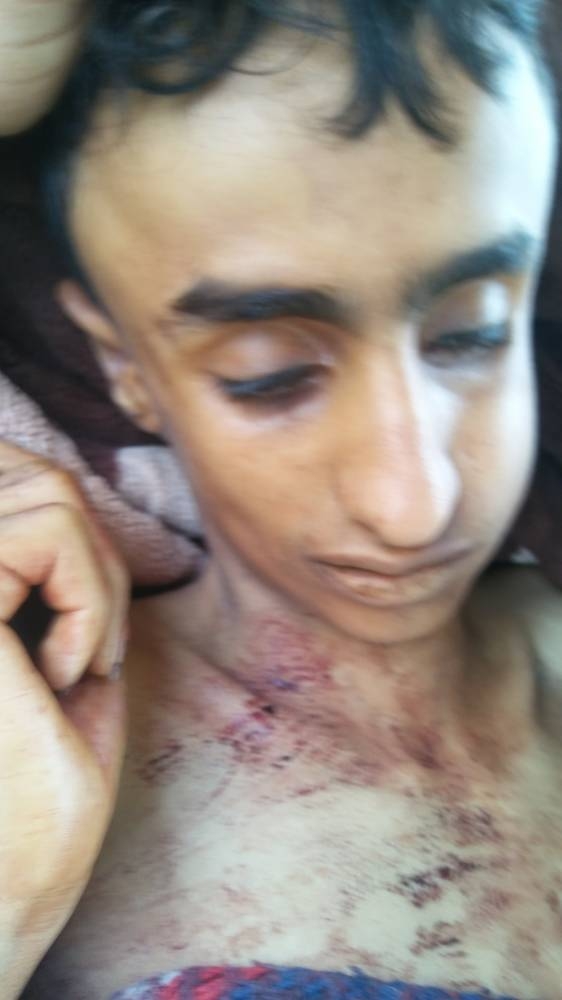 الطفل محمد القاضي الذي قتلته المليشيا في إطار صراعاتها في تعز اليوم.