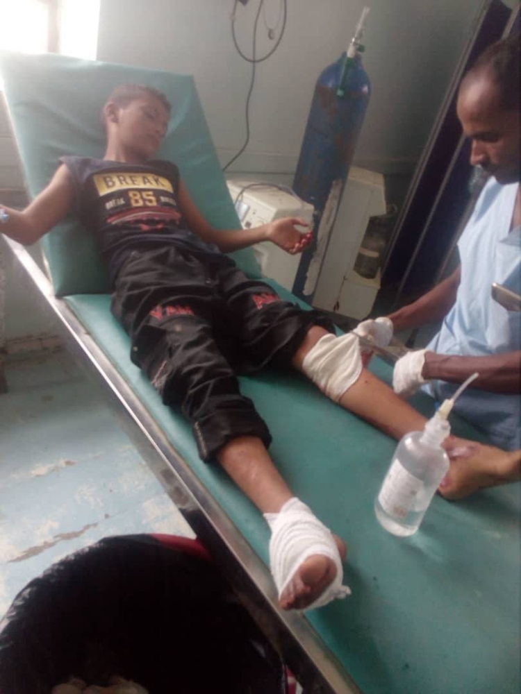 طفل يتلقى العلاج في المستشفى جرى القصف الحوثي