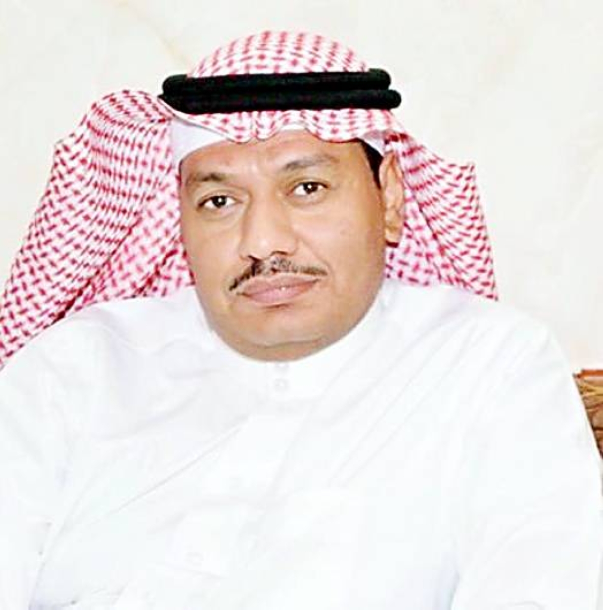 طفل يعاني من الجوع